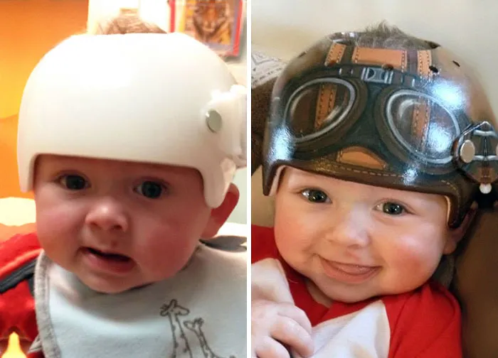 Artist Transforms Babies' Head-Shaping Helmets Into Beautiful Art
