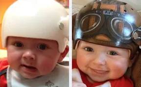 Artist Transforms Babies' Head-Shaping Helmets Into Beautiful Art