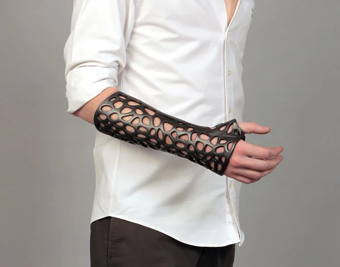 3D-Printed Plastic Cast Looks Awesome And Uses Ultrasound To Heal Broken Bones Faster