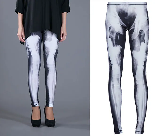 X- Ray Leggings