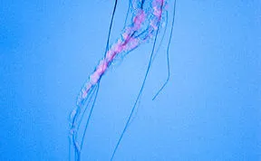 Post Your Favourite Jellyfish Photos!