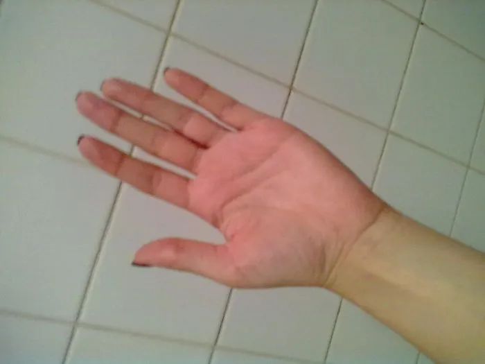:)