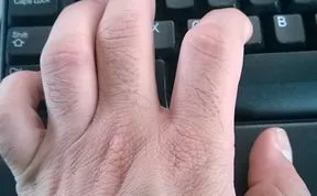 Help Me Collect 11 Million Hand Photos For My Holocaust Memorial Project