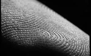 Skin Story By Kozjar's Photography