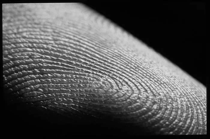Skin Story By Kozjar's Photography