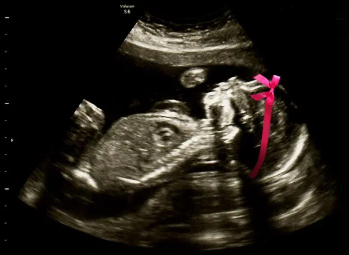 115 Of The Most Creative Baby Announcements Ever