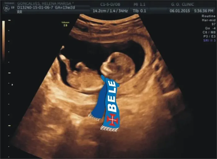 115 Of The Most Creative Baby Announcements Ever