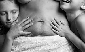 Post-Pregnancy Photo Series Shows How Mothers' Bodies Look After Giving Birth