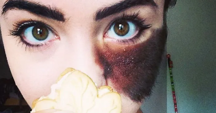 People Told Her To Remove Her Birthmark, But She Chose To Embrace It Instead