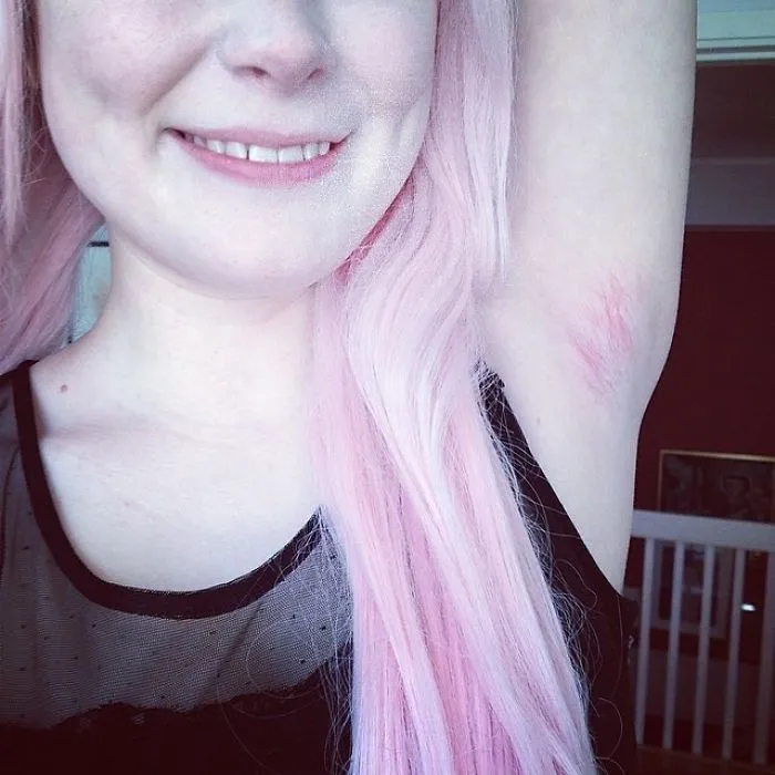 Woman Showing Her Armpit Hair