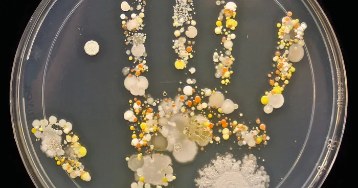 Microbes On 8-Year-Old Boy's Handprint After Playing Outside