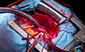 Gentle Violence: A Visual Exploration Of The Body During Open Heart Surgeries