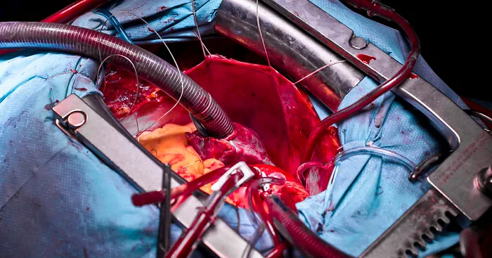 Gentle Violence: A Visual Exploration Of The Body During Open Heart Surgeries