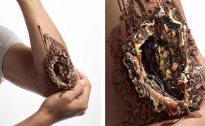 Shocking Pics Show The Dangerous Side Of Sugar