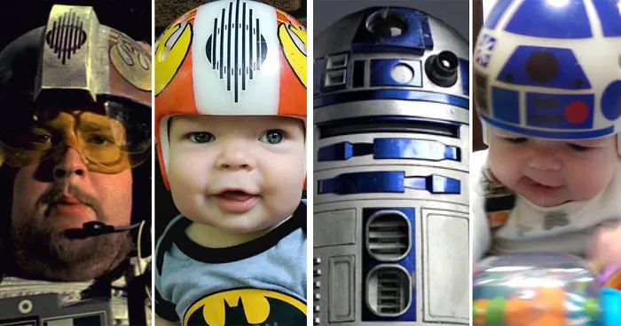 Dad Turns Son's Head-Shaping Helmets Into Star Wars Art To Wear After Surgery
