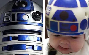Dad Turns Son's Head-Shaping Helmets Into Star Wars Art To Wear After Surgery
