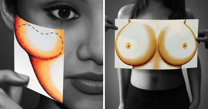 Obsession With Beauty: I Illustrate The Consequences Of Our Mania (Part 2)