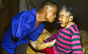 Son With No Arms Spoon-Feeds His Paralyzed Mom Using His Teeth