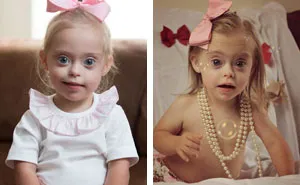 2-Year-Old Girl With Down Syndrome Wins Modeling Contract Thanks To Her Cheeky Smile