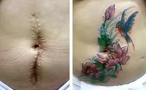 This Woman Does Free Tattoos For Survivors Of Domestic Violence
