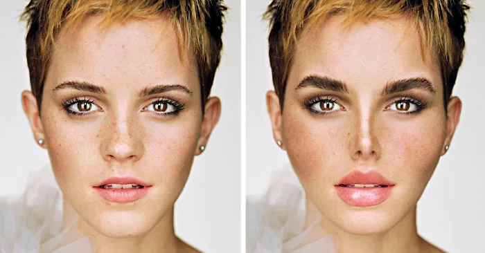 What If These Celebrities Became Obsessed With Fake Beauty And Stereotypical Plastic Surgeries ?