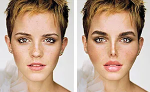 What If These Celebrities Became Obsessed With Fake Beauty And Stereotypical Plastic Surgeries ?