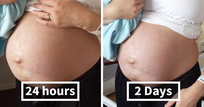 My Real Postpartum Body: I Want Every Mom To Know That It's Normal And You're Beautiful
