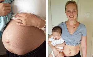 My Real Postpartum Body:  I Want Every Mom To Know That It's Normal And You're Beautiful