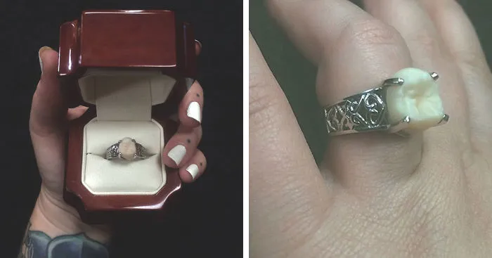 This Woman Got An Engagement Ring With Her Fiance's Wisdom Tooth