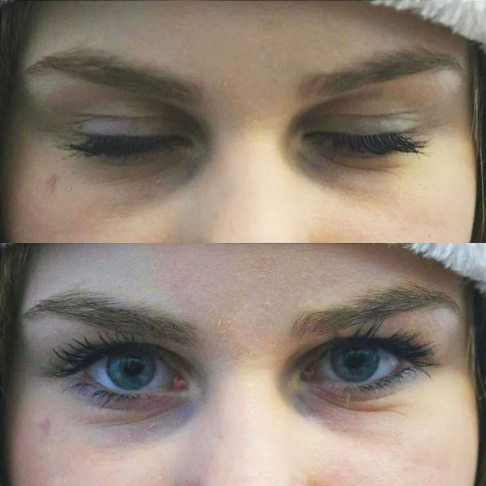 Blue Eyes