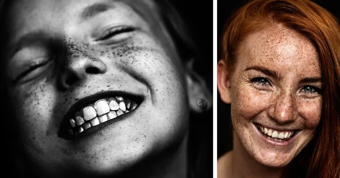 We Are Freckled: Swedish Photographer Captured 100+ Beautifully Freckled People