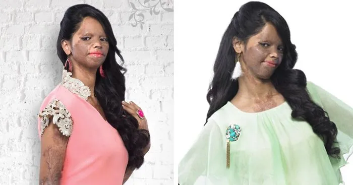 Acid Attack Survivor Becomes Face Of  Fashion Brand In India