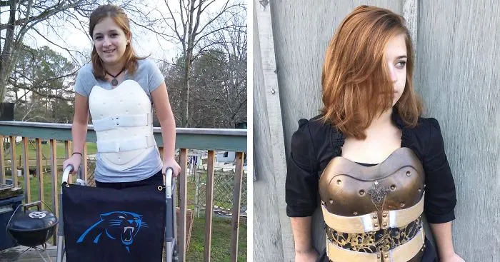 Car Crash Survivor Turns Her Back Brace Into Steampunk Armor