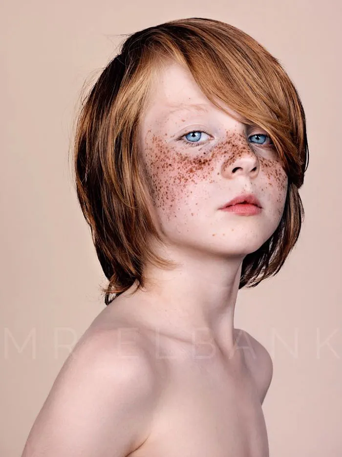 Unique Beauty Of Freckled People Documented By Brock Elbank