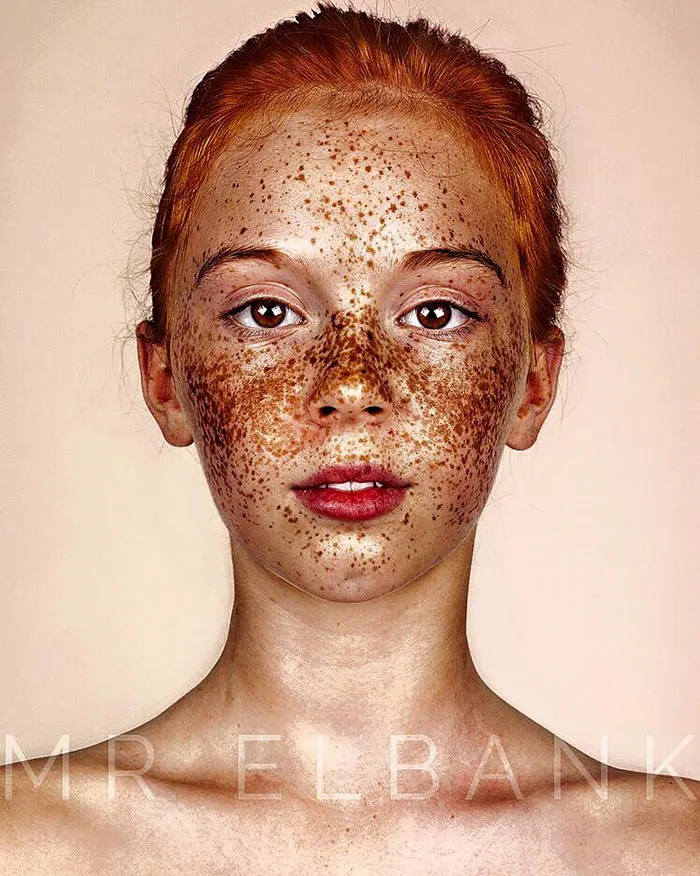 Unique Beauty Of Freckled People Documented By Brock Elbank