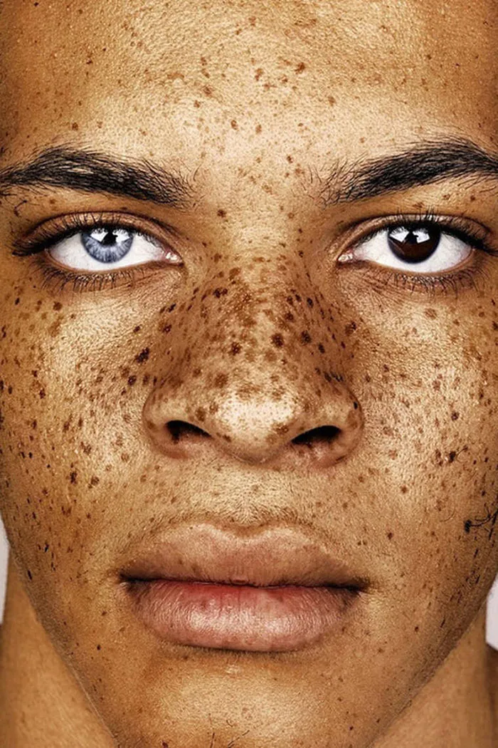 Unique Beauty Of Freckled People Documented By Brock Elbank