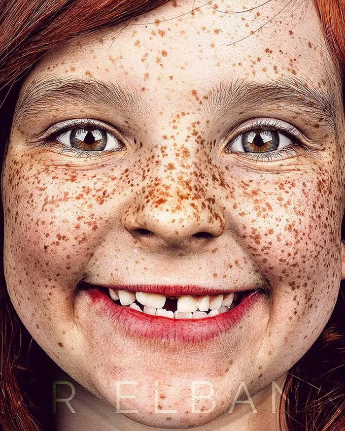 Unique Beauty Of Freckled People Documented By Brock Elbank