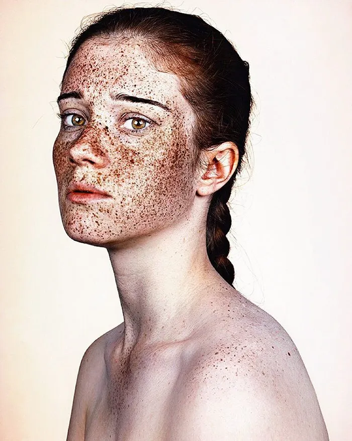 Unique Beauty Of Freckled People Documented By Brock Elbank