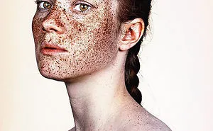 Unique Beauty Of Freckled People Documented By Brock Elbank