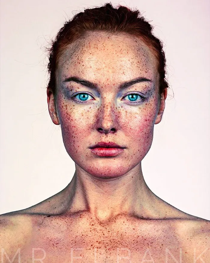 Unique Beauty Of Freckled People Documented By Brock Elbank