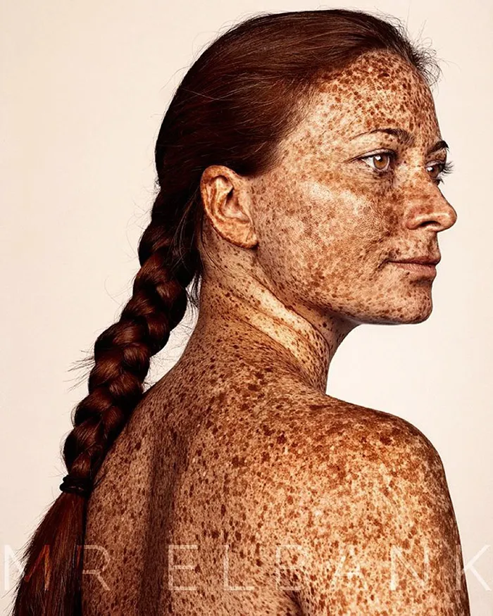 Unique Beauty Of Freckled People Documented By Brock Elbank