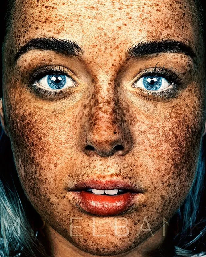 Unique Beauty Of Freckled People Documented By Brock Elbank
