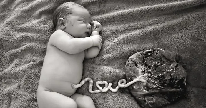 Mom Celebrates Birth With A Pic Of Her Newborn's Umbilical Cord Spelling Out 'LOVE'