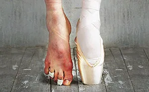 The Cost Of Applause: 77 Pics To Celebrate Ballet Day