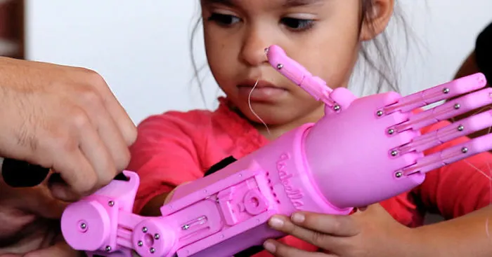 5-Year-Old Born With An Underdeveloped Hand Gets A 3D Printed One