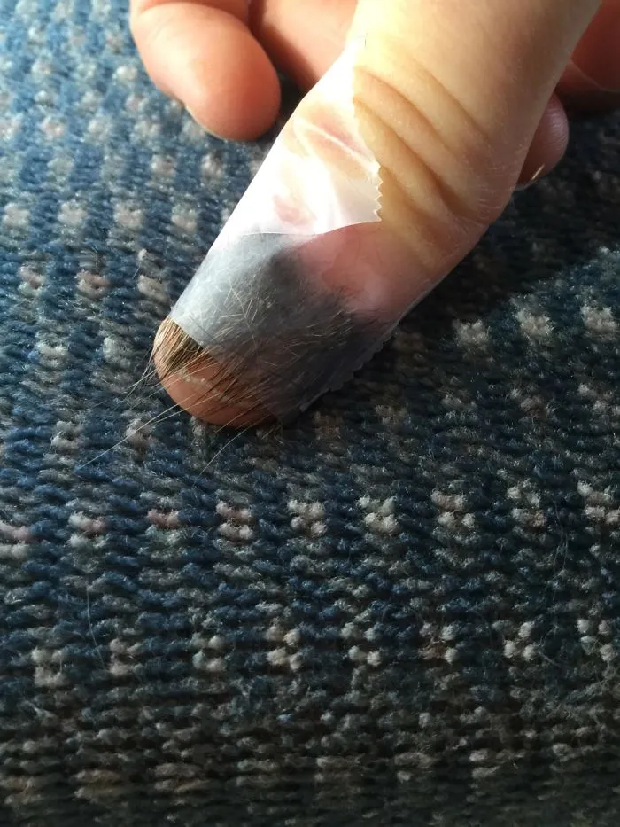 Peeling Back The Unexpected