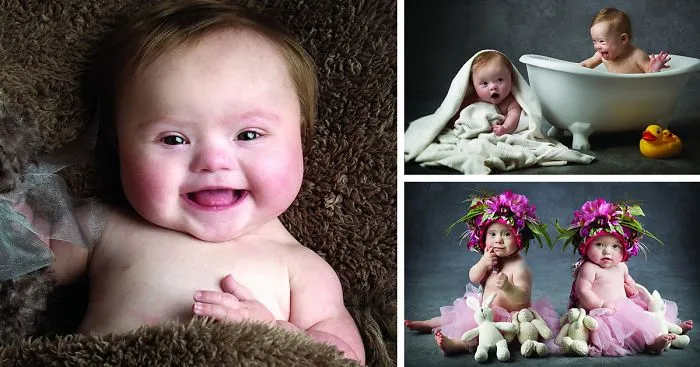 Babies with Down's Syndrome Pose For Adorable Charity Photoshoot