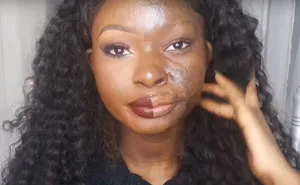 Burn Survivor Bullied At School Becomes Makeup Artist To Help Other Victims