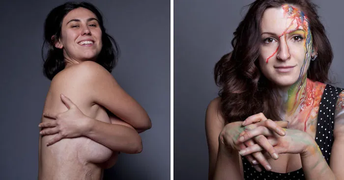 I Photographed Personal Portraits Showing The Different Ways To Live One's Own Skin