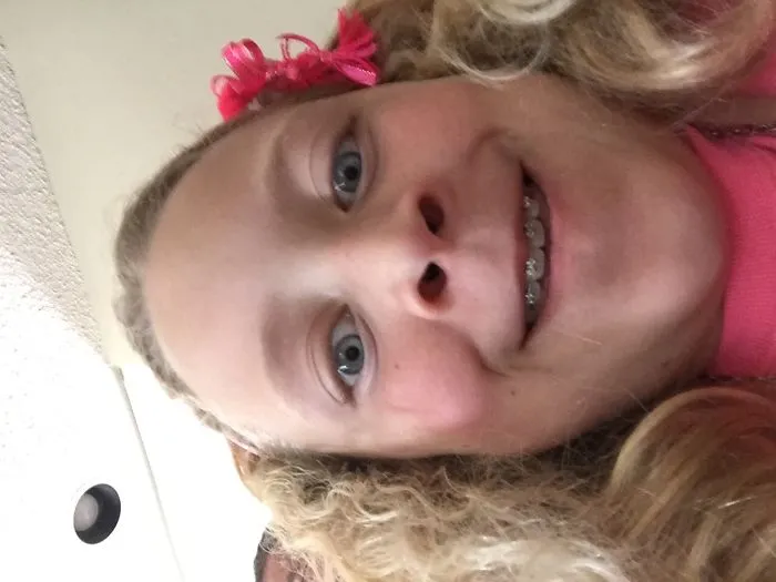 This Is My Sis Her Hiar Is Not That Bad On This Day